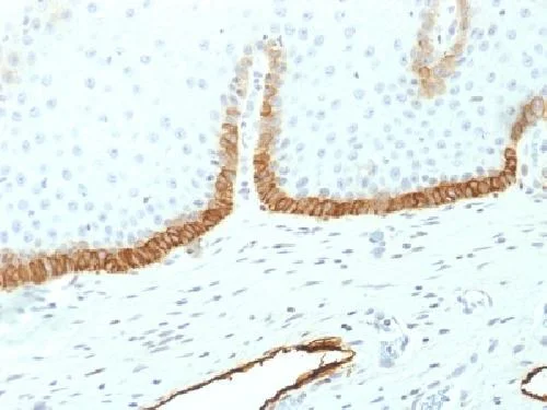 Immunohistochemistry (Formalin/PFA-fixed paraffin-embedded sections) - Anti-Podoplanin antibody [PDPN/1433] - BSA and Azide free (AB234036)