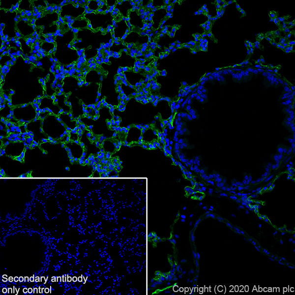 Immunohistochemistry (Frozen sections) - Anti-Podoplanin antibody [PMab-1] (AB256559)