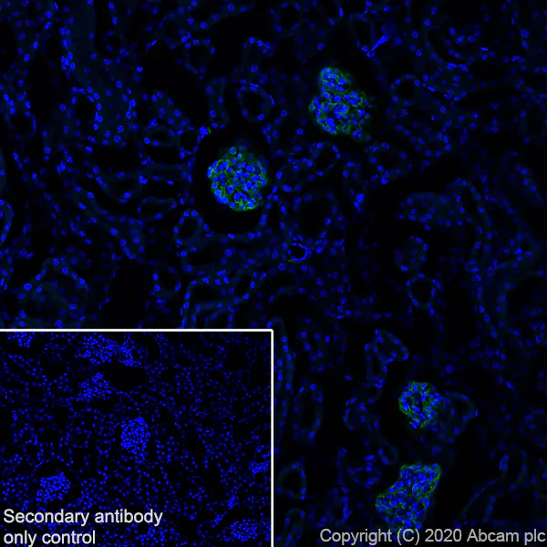 Immunohistochemistry (Frozen sections) - Anti-Podoplanin antibody [PMab-1] (AB256559)