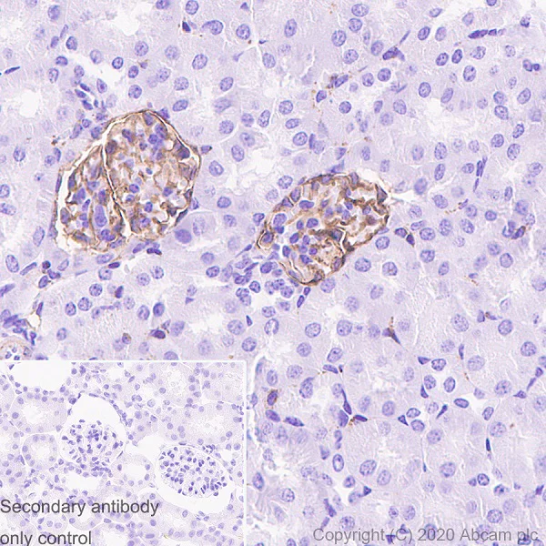 Immunohistochemistry (Formalin/PFA-fixed paraffin-embedded sections) - Anti-Podoplanin antibody [PMab-1] - BSA and Azide free (AB256564)