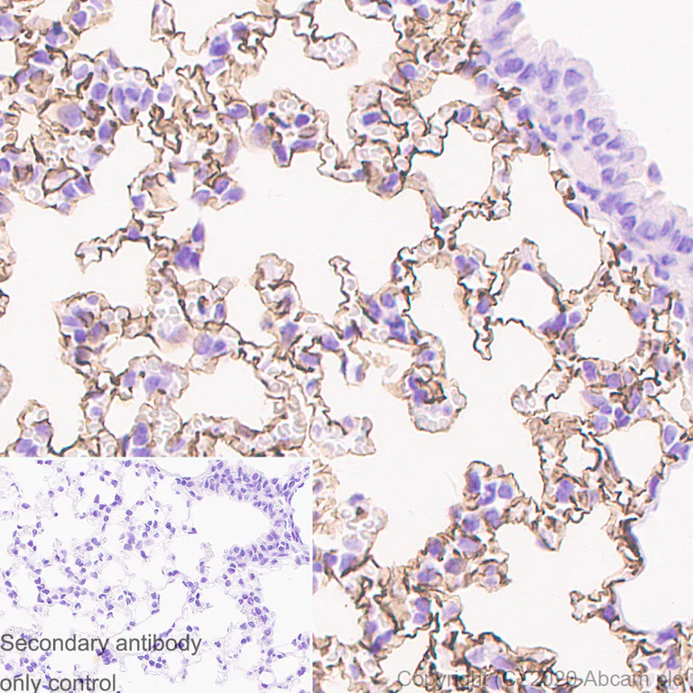 Immunohistochemistry (Formalin/PFA-fixed paraffin-embedded sections) - Anti-Podoplanin antibody [PMab-1] - BSA and Azide free (AB256564)