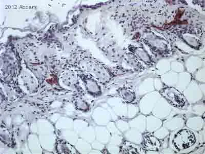 Immunohistochemistry (Formalin/PFA-fixed paraffin-embedded sections) - Anti-Podoplanin antibody [RTD4E10] - BSA and Azide free (AB11936)