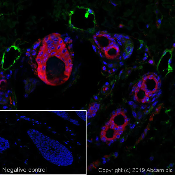 Immunohistochemistry (Formalin/PFA-fixed paraffin-embedded sections) - Anti-Podoplanin antibody [RTD4E10] - BSA and Azide free (AB11936)