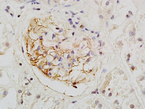 Immunohistochemistry (Formalin/PFA-fixed paraffin-embedded sections) - Anti-PODXL antibody - C-terminal (AB203079), expandable thumbnail