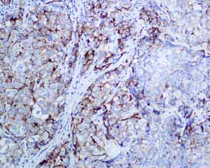Immunohistochemistry (Formalin/PFA-fixed paraffin-embedded sections) - Anti-PODXL antibody [EPR9518] (ab150358), expandable thumbnail