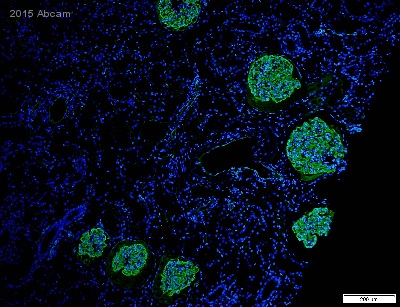 Immunohistochemistry (Formalin/PFA-fixed paraffin-embedded sections) - Anti-PODXL antibody [EPR9518] (ab150358), expandable thumbnail