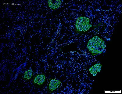 Immunohistochemistry (Formalin/PFA-fixed paraffin-embedded sections) - Anti-PODXL antibody [EPR9518] (AB150358)