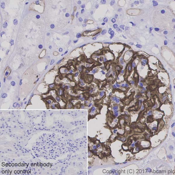 Immunohistochemistry (Formalin/PFA-fixed paraffin-embedded sections) - Anti-PODXL antibody [EPR9518] (AB150358), expandable thumbnail