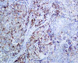 Immunohistochemistry (Formalin/PFA-fixed paraffin-embedded sections) - Anti-PODXL antibody [EPR9518] - BSA and Azide free (AB269888)