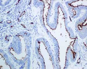 Immunohistochemistry (Formalin/PFA-fixed paraffin-embedded sections) - Anti-PODXL antibody [EPR9518] - BSA and Azide free (AB269888)