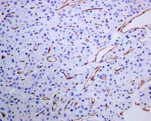 Immunohistochemistry (Formalin/PFA-fixed paraffin-embedded sections) - Anti-PODXL antibody [EPR9518] - BSA and Azide free (AB269888)