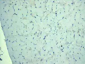 Immunohistochemistry (Formalin/PFA-fixed paraffin-embedded sections) - Anti-PODXL antibody [EPR9518] - BSA and Azide free (AB269888)