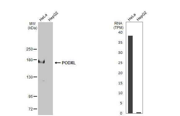 Western blot - Anti-PODXL antibody [HL2047] (AB317128)