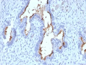 Immunohistochemistry (Formalin/PFA-fixed paraffin-embedded sections) - Anti-PODXL antibody [PODXL/2185] (AB236559)