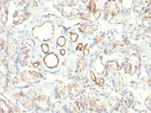 Immunohistochemistry (Formalin/PFA-fixed paraffin-embedded sections) - Anti-PODXL antibody [PODXL/2185] (AB236559)