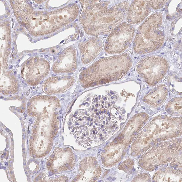 Immunohistochemistry (Formalin/PFA-fixed paraffin-embedded sections) - Anti-POGLUT1 antibody (AB272623)