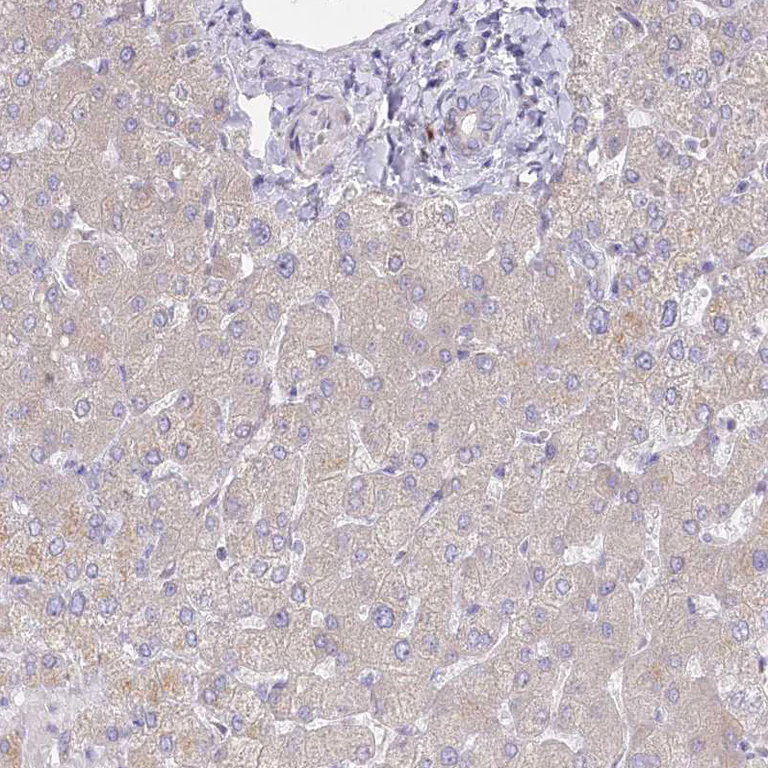 Immunohistochemistry (Formalin/PFA-fixed paraffin-embedded sections) - Anti-POGLUT1 antibody (AB272623)