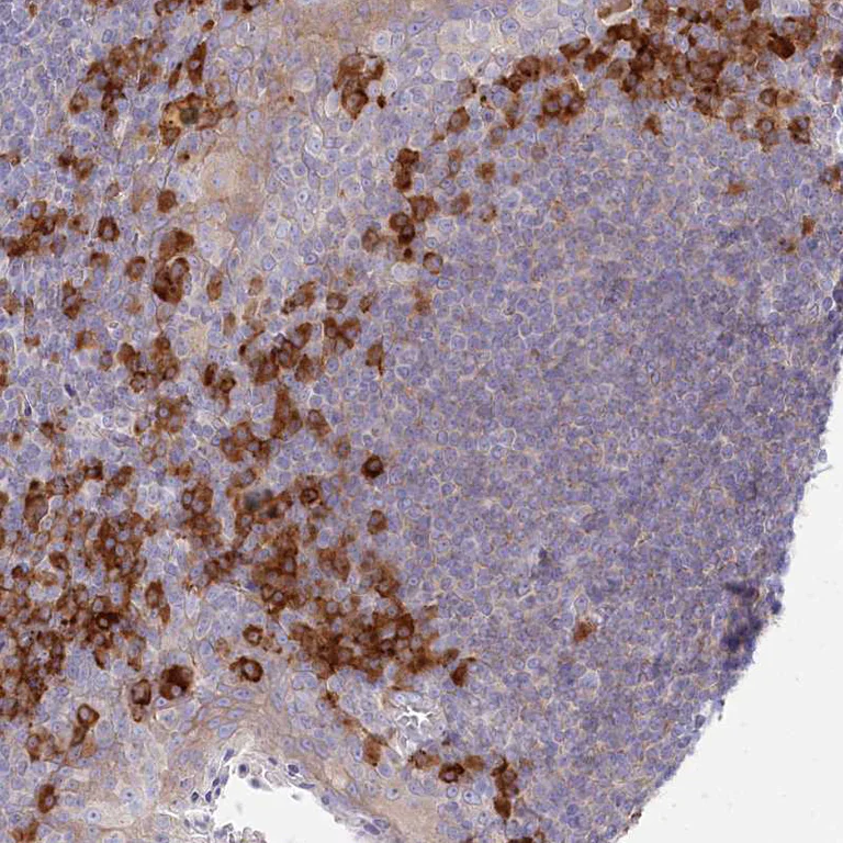 Immunohistochemistry (Formalin/PFA-fixed paraffin-embedded sections) - Anti-POGLUT1 antibody (AB272623)