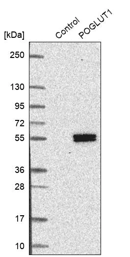Western blot - Anti-POGLUT1 antibody (AB272623)