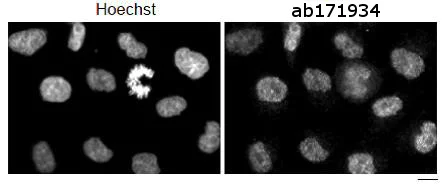 Immunocytochemistry/ Immunofluorescence - Anti-POGZ antibody (AB171934)
