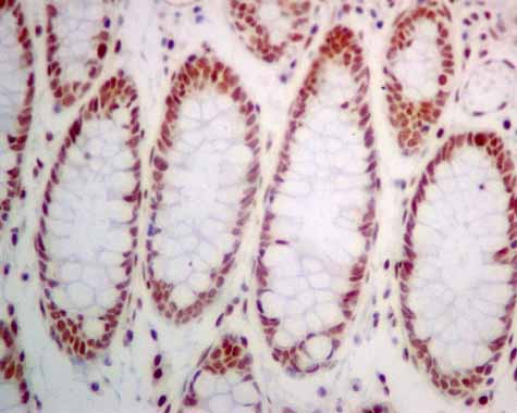 Immunohistochemistry (Formalin/PFA-fixed paraffin-embedded sections) - Anti-POGZ antibody [EPR10612] (AB167408), expandable thumbnail