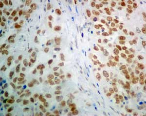 Immunohistochemistry (Formalin/PFA-fixed paraffin-embedded sections) - Anti-POGZ antibody [EPR10612] (ab167408), expandable thumbnail