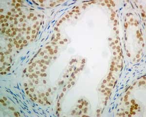 Immunohistochemistry (Formalin/PFA-fixed paraffin-embedded sections) - Anti-POGZ antibody [EPR10612] (ab167408), expandable thumbnail
