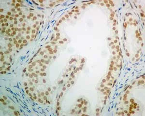 Immunohistochemistry (Formalin/PFA-fixed paraffin-embedded sections) - Anti-POGZ antibody [EPR10612] (AB167408)
