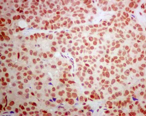 Immunohistochemistry (Formalin/PFA-fixed paraffin-embedded sections) - Anti-POGZ antibody [EPR10612] (AB167408), expandable thumbnail