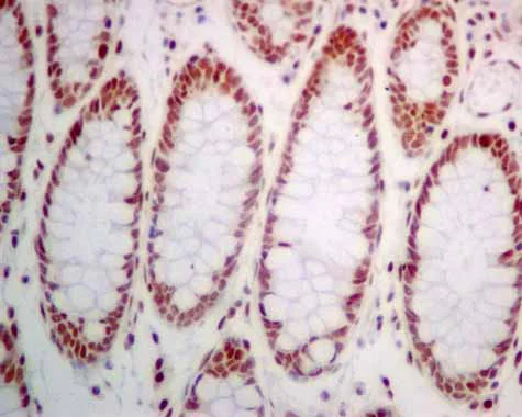 Immunohistochemistry (Formalin/PFA-fixed paraffin-embedded sections) - Anti-POGZ antibody [EPR10612] - BSA and Azide free (AB249423)