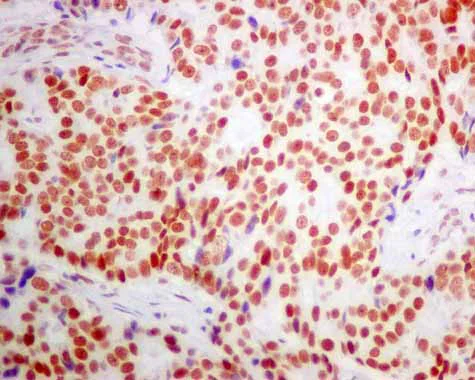 Immunohistochemistry (Formalin/PFA-fixed paraffin-embedded sections) - Anti-POGZ antibody [EPR10612] - BSA and Azide free (AB249423)