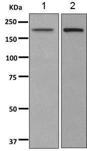 Western blot - Anti-POGZ antibody [EPR10612] - BSA and Azide free (AB249423)