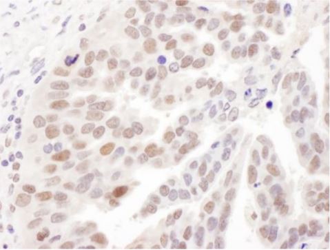 Immunohistochemistry (Formalin/PFA-fixed paraffin-embedded sections) - Anti-POLD1 antibody (AB168827)