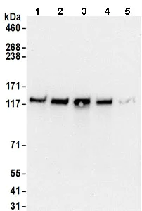 Western blot - Anti-POLD1 antibody (AB168827)