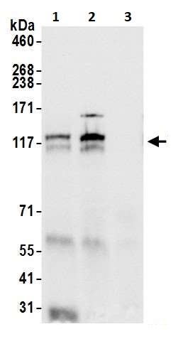 Immunoprecipitation - Anti-POLD1 antibody (AB264345)