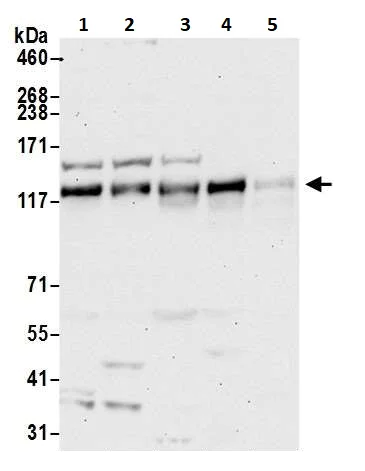Western blot - Anti-POLD1 antibody (AB264345)