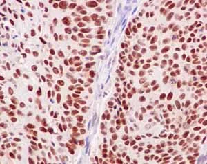 Immunohistochemistry (Formalin/PFA-fixed paraffin-embedded sections) - Anti-POLD1 antibody [EPR15118] - BSA and Azide free (AB240300)