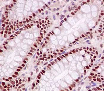 Immunohistochemistry (Formalin/PFA-fixed paraffin-embedded sections) - Anti-POLD1 antibody [EPR15118] - BSA and Azide free (AB240300)