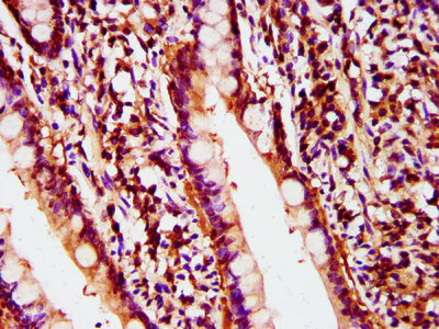 Immunohistochemistry (Formalin/PFA-fixed paraffin-embedded sections) - Anti-POLD2 antibody (AB238834)