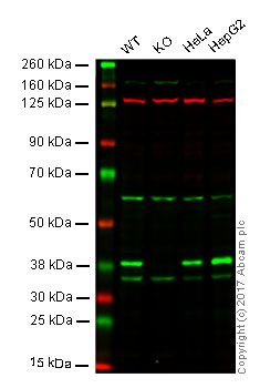Anti-POLDIP2 antibody [EPR13832]