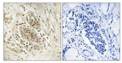 Immunohistochemistry (Formalin/PFA-fixed paraffin-embedded sections) - Anti-POLE antibody (AB110876)
