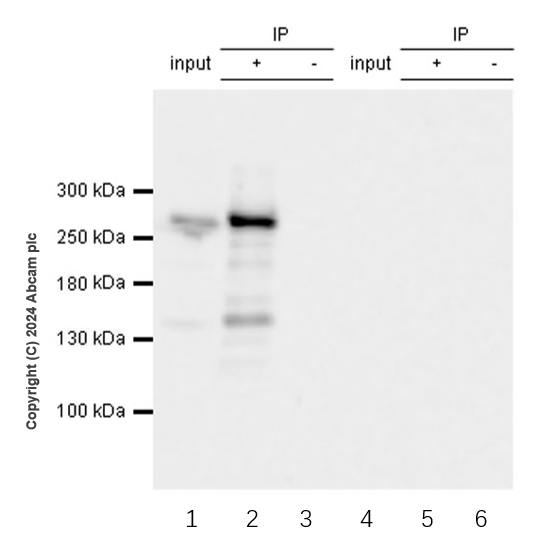 Immunoprecipitation - Anti-POLE antibody [EPR28639-64] (AB318968), expandable thumbnail