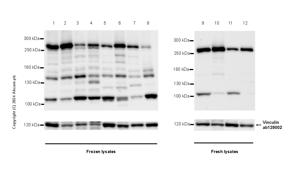 Western blot - Anti-POLE antibody [EPR28639-64] (AB318968), expandable thumbnail
