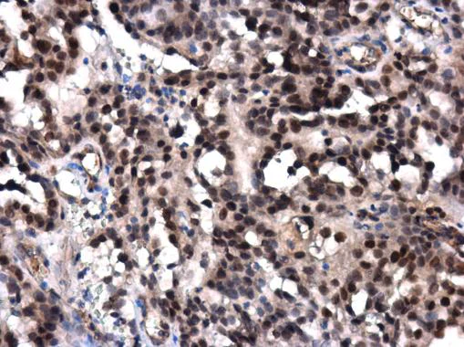 Immunohistochemistry (Formalin/PFA-fixed paraffin-embedded sections) - Anti-POLE antibody - N-terminal (AB226848)