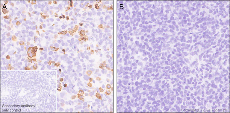 Immunohistochemistry (Formalin/PFA-fixed paraffin-embedded sections) - Anti-POLE (mutated P286R) antibody [EPR28640-56] - BSA and Azide free (AB318137)