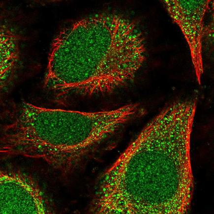 Immunocytochemistry/ Immunofluorescence - Anti-POLE4 antibody (AB220694)