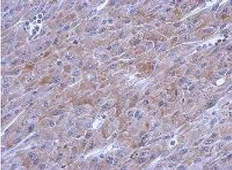 Immunohistochemistry (Formalin/PFA-fixed paraffin-embedded sections) - Anti-POLG antibody (AB154310)