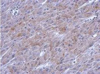 Immunohistochemistry (Formalin/PFA-fixed paraffin-embedded sections) - Anti-POLG antibody (AB154310)