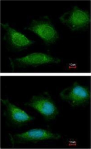 Immunocytochemistry/ Immunofluorescence - Anti-POLG antibody (AB97661), expandable thumbnail