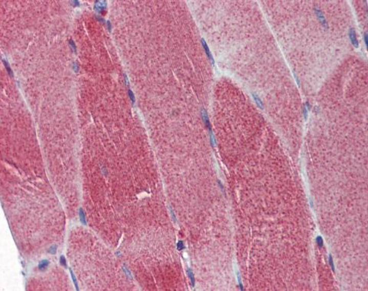 Immunohistochemistry (Formalin/PFA-fixed paraffin-embedded sections) - Anti-POLG antibody (AB97661), expandable thumbnail